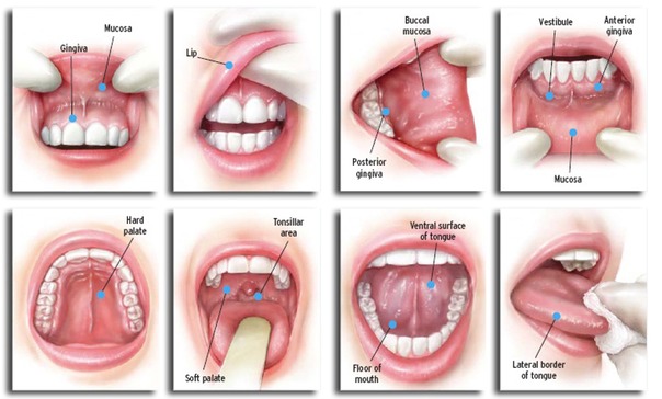 Oral Cancer Screening